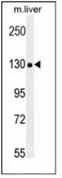 AP51011PU-N - Collagen type XVIII alpha 1 chain