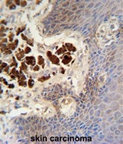 AP51012PU-N - Collagen type XIX alpha 1 chain