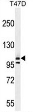 AP51013PU-N - Collagen type I alpha 2 chain
