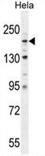 AP51015PU-N - Collagen type IV alpha 2 chain
