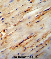 AP51017PU-N - Collagen type V