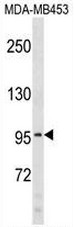 AP51018PU-N - Collagen type VI alpha 2 chain