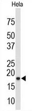 AP51031PU-N - COX IV isoform 1