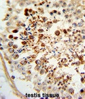 AP51033PU-N - Complex IV subunit VIaL