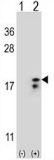 AP51033PU-N - Complex IV subunit VIaL