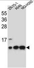 AP51035PU-N - Complex IV subunit VIb