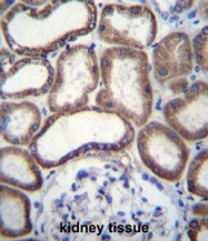AP51035PU-N - Complex IV subunit VIb