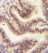 AP51042PU-N - C16orf45