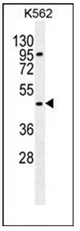 AP51045PU-N - Carboxypeptidase A3