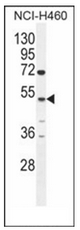 AP51046PU-N - Carboxypeptidase A6