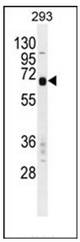 AP51052PU-N - Carboxypeptidase M