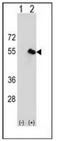 AP51053PU-N - Carboxypeptidase N catalytic chain