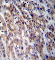 AP51053PU-N - Carboxypeptidase N catalytic chain