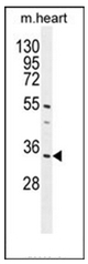 AP51067PU-N - C18orf25