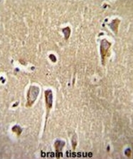 AP51079PU-N - CRHR2