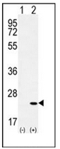 AP51081PU-N - Corticoliberin
