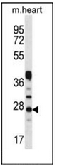 AP51091PU-N - Beta-crystallin A3