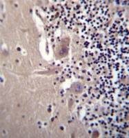 AP51091PU-N - Beta-crystallin A3