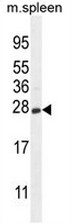 AP51093PU-N - Beta-crystallin S