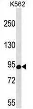 AP51096PU-N - UNR protein / CSDE1