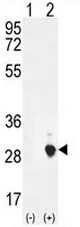 AP51099PU-N - Placental Lactogen
