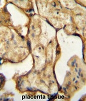 AP51099PU-N - Placental Lactogen