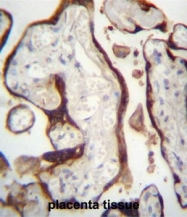 AP51100PU-N - CSHL1