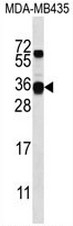 AP51102PU-N - Beta-casein