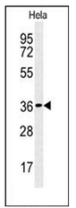 AP51119PU-N - CTDSPL