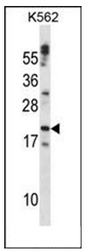 AP51121PU-N - Cardiotrophin-1