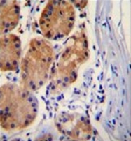 AP51124PU-N - Catenin beta-1