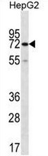 AP51128PU-N - CTP synthase 2