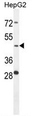 AP51129PU-N - Cathepsin A
