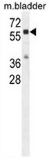 AP51129PU-N - Cathepsin A