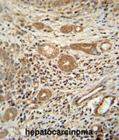 AP51129PU-N - Cathepsin A