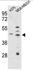 AP51130PU-N - Cathepsin D