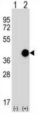 AP51131PU-N - Cathepsin K