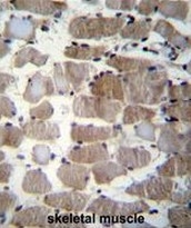 AP51131PU-N - Cathepsin K