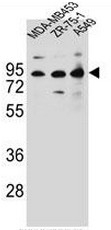 AP51136PU-N - CTTNBP2NL