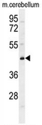 AP51155PU-N - Neuferricin