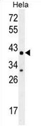 AP51160PU-N - Cytochrome C1