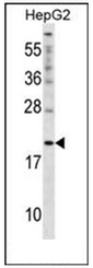 AP51162PU-N - Cytoglobin