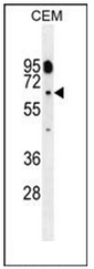 AP51163PU-N - CYP11B2