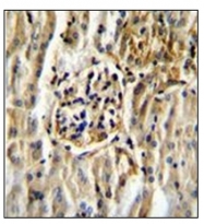 AP51163PU-N - CYP11B2