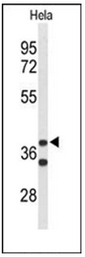 AP51177PU-N - Cytohesin 3