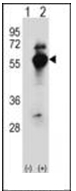 AP51185PU-N - DARS1