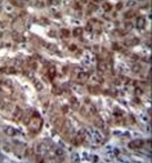 AP51185PU-N - DARS1