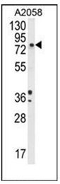 AP51191PU-N - Dopamine beta-hydroxylase