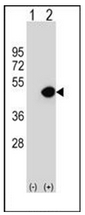 AP51207PU-N - Dynactin subunit 2