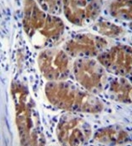 AP51207PU-N - Dynactin subunit 2